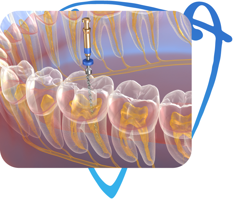 Endodonzia