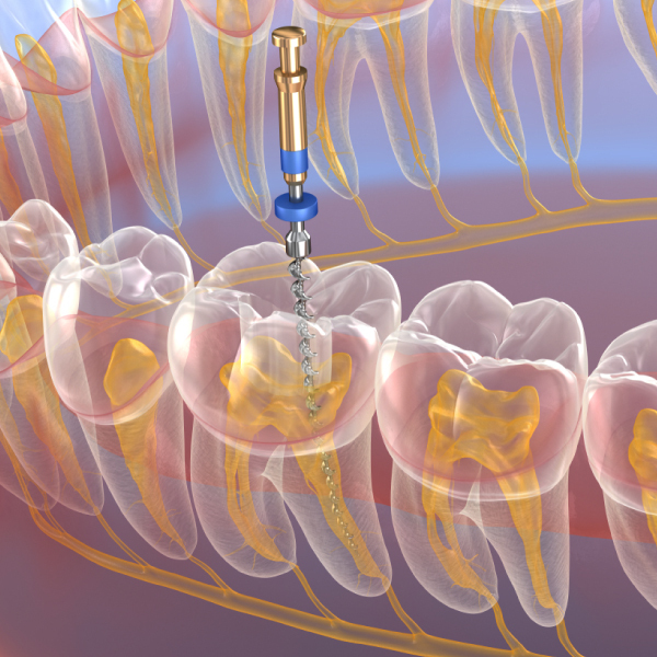 Conservativa  e Endodonzia